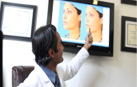 3D Vectra Imaging by Dr. Torkian at Lasky Clinic